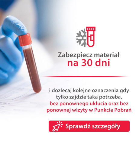 pieluchomajtki dla dorosłych gdzie przód